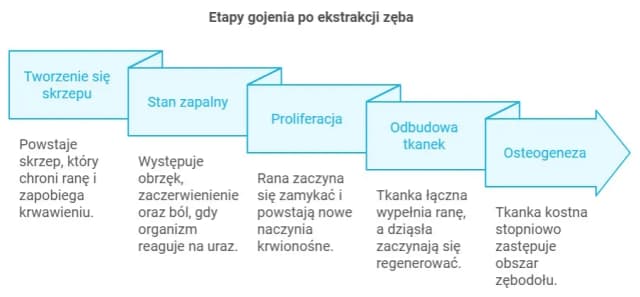 Jak długo goi się dziąsło po wyrwaniu zęba i jak uniknąć powikłań? Jak długo goi się dziąsło po wyrwaniu zęba i jak uniknąć powikłań?